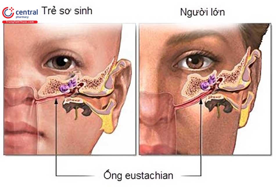 Giải phẩu học tai mũi họng của trẻ khác với người lớn