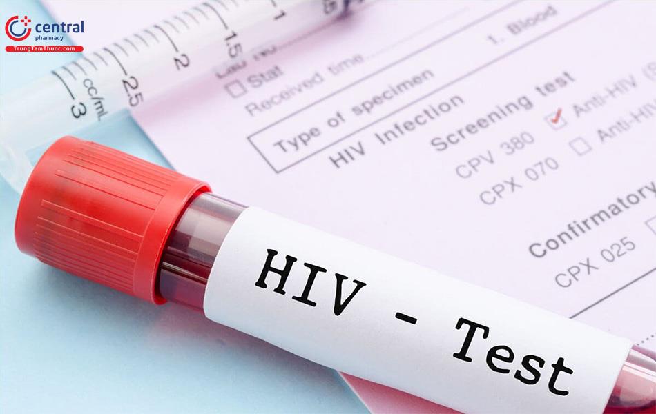 Xét nghiệm máu tìm sự có mặt của virus HIV