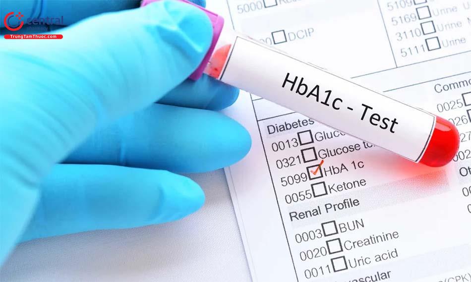 Chỉ số HbA1c: định nghĩa, chỉ số bình thường, ý nghĩa 