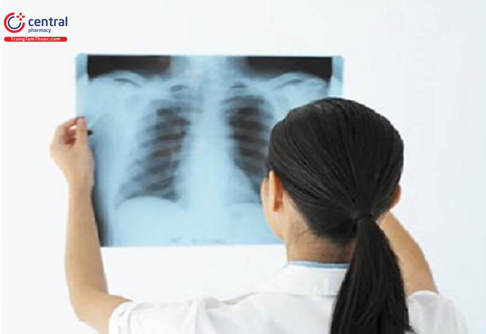 Chụp X - quang phổi để thấy hình ảnh phổi tổn thương.