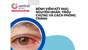 Bệnh viêm kết mạc (đau mắt đỏ): Nguyên nhân, triệu chứng và cách phòng tránh