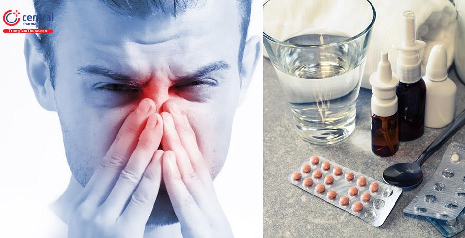 [REVIEW] 7 thuốc trị viêm mũi dị ứng hiệu quả mà bạn nên biết