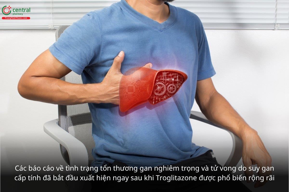 Biến cố Troglitazone (Rezulin)