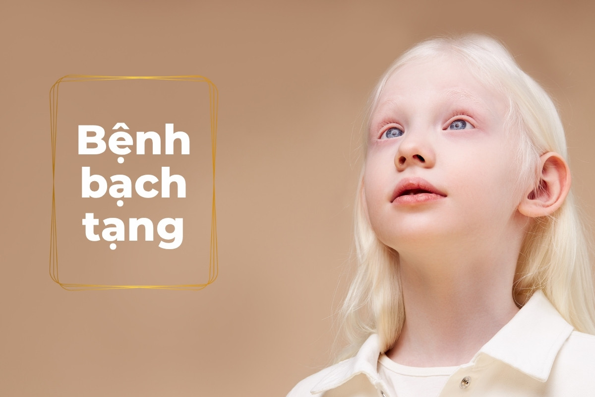 Bệnh bạch tạng