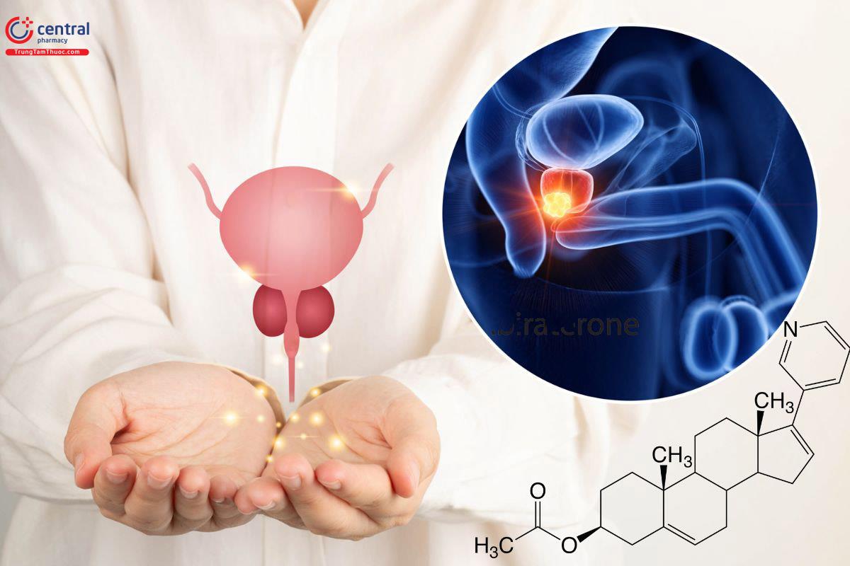 Abiraterone điều trị ung thư tiền liệt tuyến