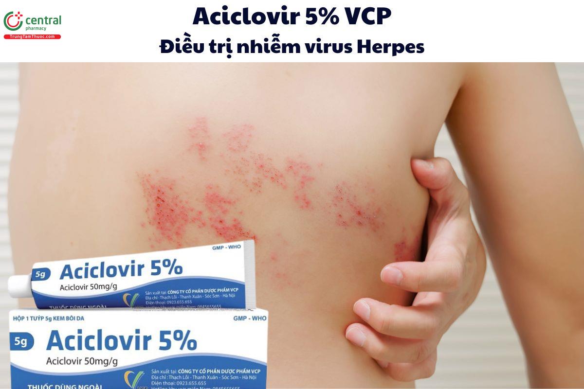 Thuốc Aciclovir 5% VCP - Kem bôi da điều trị các bệnh nhiễm virus Herpes