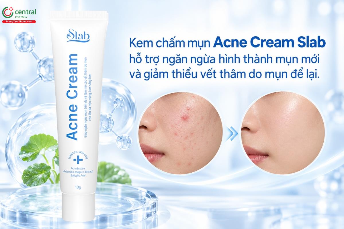 Kem chấm mụn Acne Cream Slab hỗ trợ ngăn ngừa hình thành mụn mới và giảm thiểu vết thâm do mụn để lại
