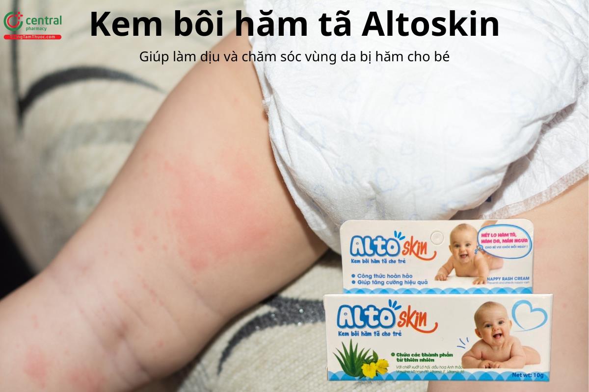 Kem bôi hăm tã Altoskin làm dịu và chăm sóc vùng da bị hăm cho bé