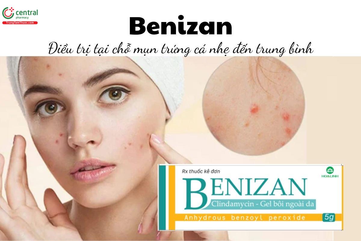 Thuốc Benizan - Điều trị tại chỗ mụn trứng cá nhẹ đến trung bình
