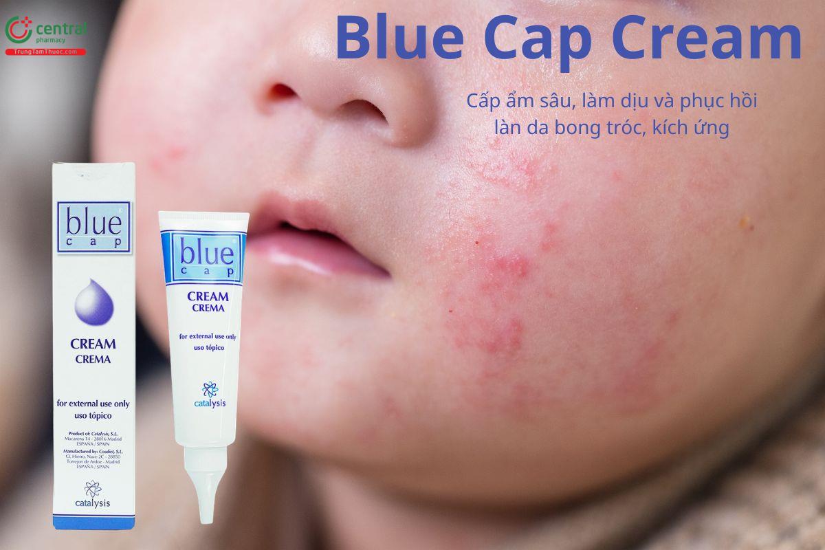 Blue Cap Cream giúp cấp ẩm và phục hồi làn da bong tróc, kích ứng