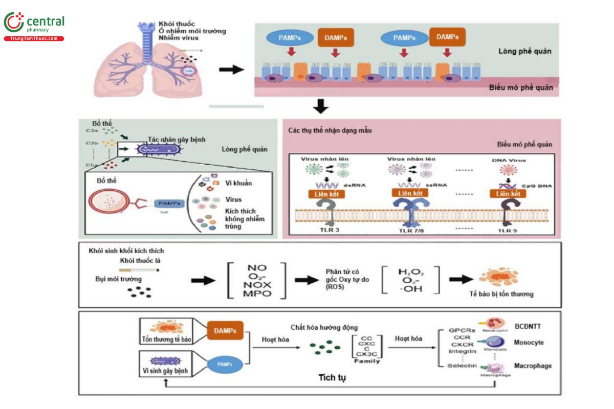 Hình 1. Sơ đồ các yếu tố nhiễm trùng và không nhiễm trùng xâm nhập vào tế bào biểu mô của bệnh nhân COPD. Cơ sở viêm này là cơ sở giải thích cho khuynh hướng sinh lý của AECOPD khi tiếp xúc với nhiều kích thích khác nhau. (Nguồn trích dẫn: Yadan Tu et al. Advances in acute COPD exacerbation: clarifying specific immune mechanisms of  infectious and noninfectious factors. Ther Adv Respir Dis 2025, Vol. 19: 1–18).