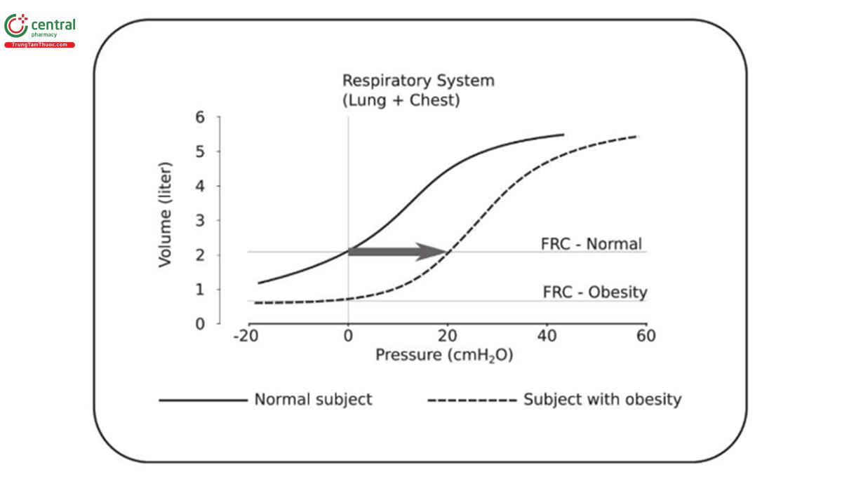 HÌNH 2. So sánh FRC ở người béo phì và người bình thường. Tái tạo đường cong áp lực thể tích ở đối tượng bình thường và ở đối tượng béo phì. Trong hệ hô hấp bình thường, FRC cao hơn thể tích đóng. Tăng áp lực màng phổi (PPL) xác định mức giảm FRC gần với thể tích đóng. Trong ví dụ, để duy trì cùng một FRC, áp lực đường thở ở đối tượng béo phì cần tăng khoảng 20 cmH2O so với áp lực khí quyển. FRC, dung tích cặn chức năng.