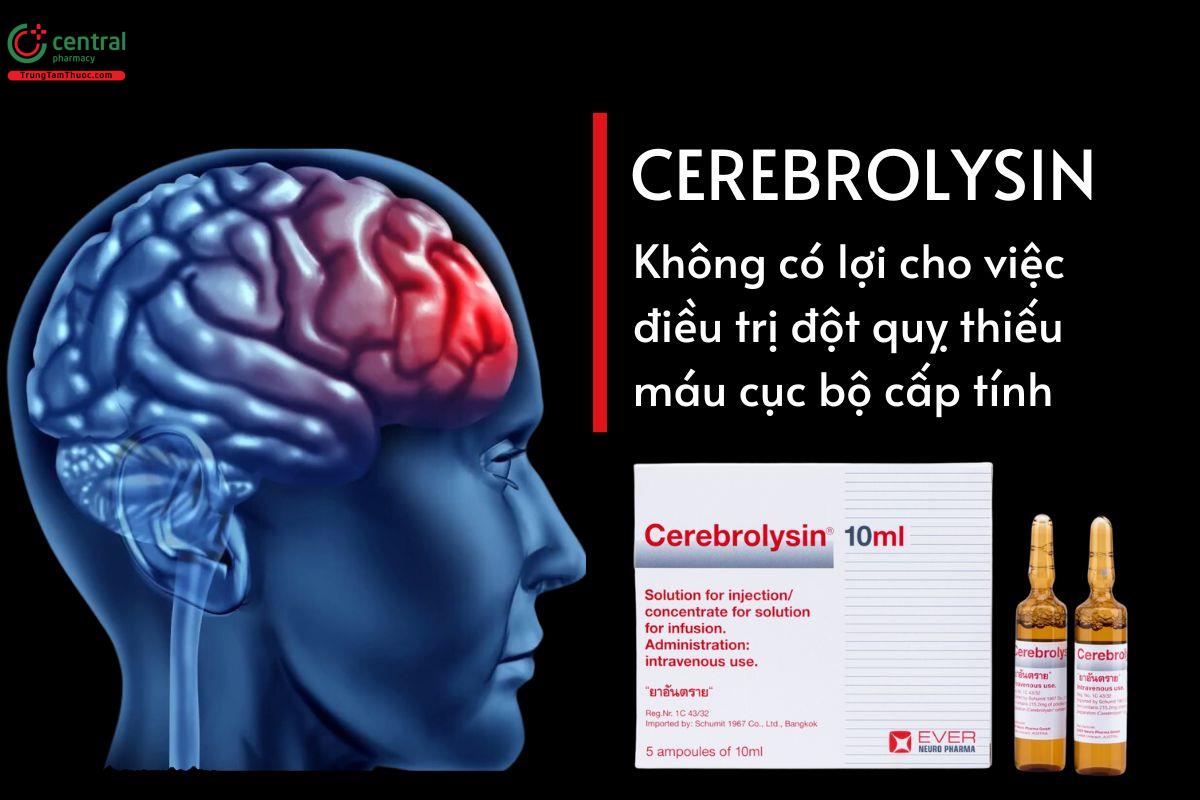 Cerebrolysin không có lợi ích cho đột quỵ thiếu máu cục bộ cấp tính