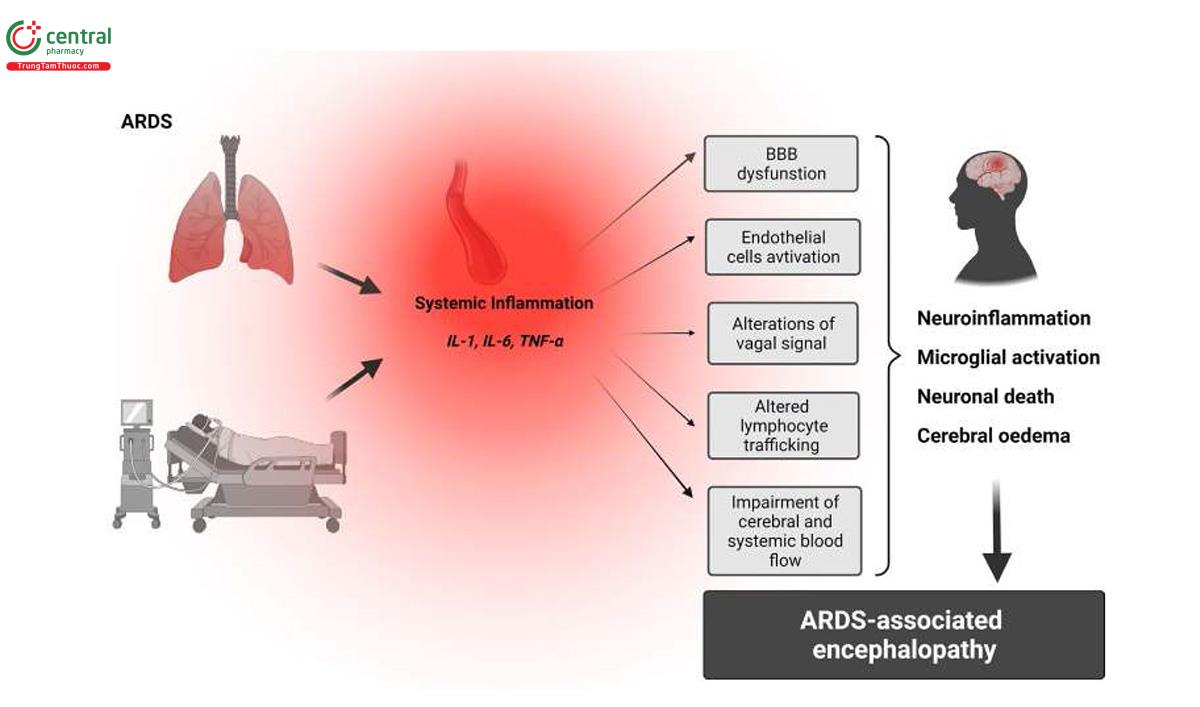 Hình 2 Vai trò của tình trạng viêm trong sự phát triển chấn thương não thứ phát liên quan đến ARDS. Giảm oxy máu và thở máy gây ra một số phản ứng toàn thân bao gồm giải phóng các chất trung gian gây viêm trong tuần hoàn hệ thống, sau đó là rối loạn chức năng BBB tiềm ẩn, kích hoạt tế bào nội mô, thay đổi vận chuyển tế bào lympho và suy giảm lưu lượng máu não và hệ thống. Những tín hiệu hướng tâm và các chất trung gian gây viêm tuần hoàn này có thể gây ra viêm thần kinh, kích hoạt vi mô, chết tế bào thần kinh và phù não, góp phần có khả năng phát triển bệnh não liên quan đến ARDS.