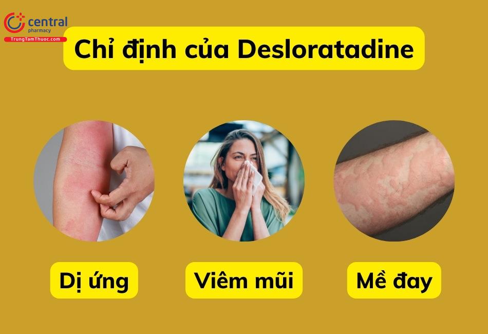 Desloratadine được sử dụng để làm giảm các triệu chứng của dị ứng như nổi mẩn, ngứa ngáy