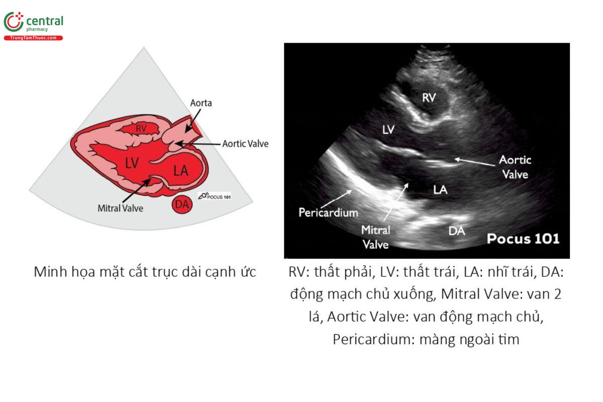 Mặt cắt trục dài cạnh ức