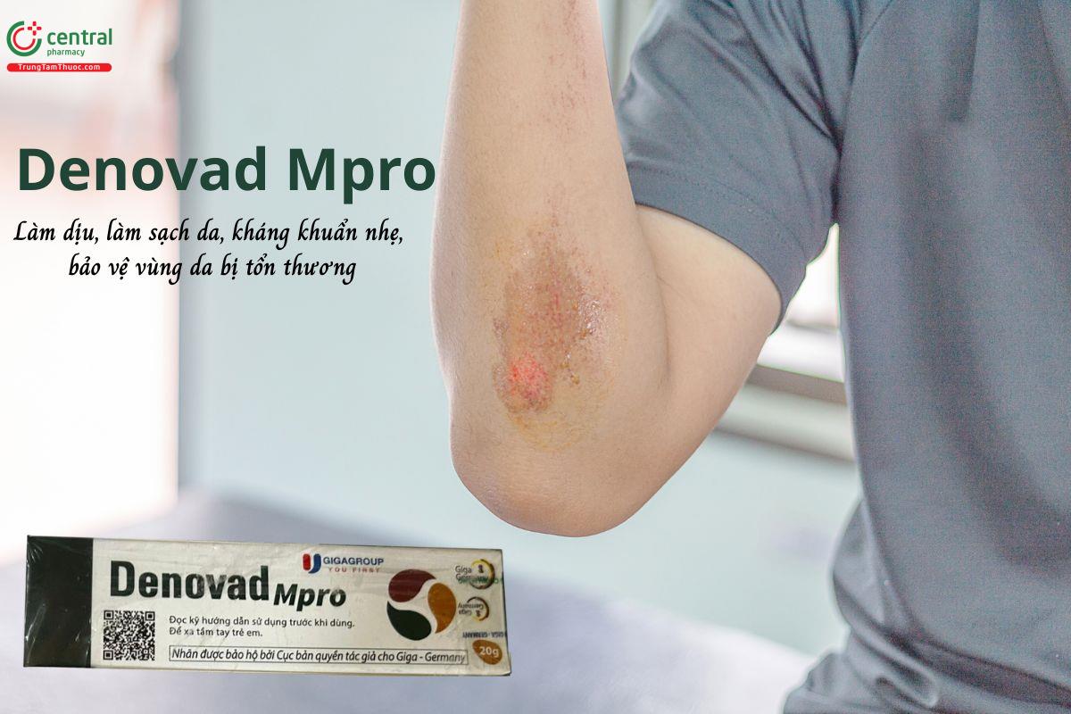 Denovad Mpro - Kem bôi kháng khuẩn, làm sạch, làm dịu, bảo vệ da