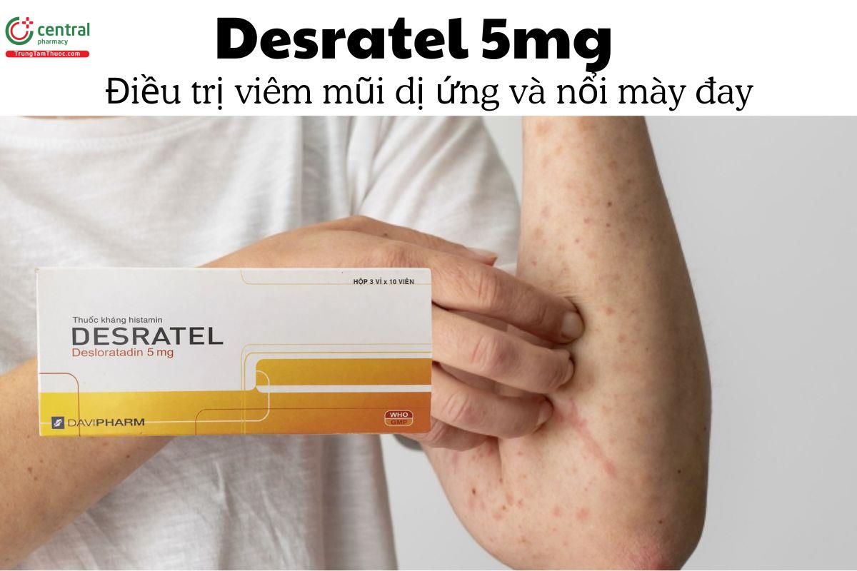 Thuốc Desratel 5mg - điều trị viêm mũi dị ứng và nổi mày đay