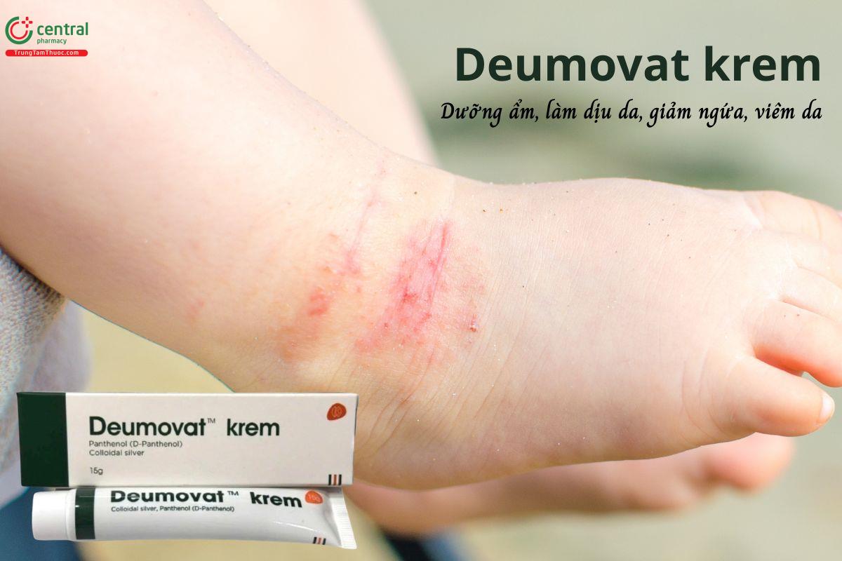 Deumovat krem - Dưỡng ẩm, làm dịu da, giảm viêm da, kích ứng