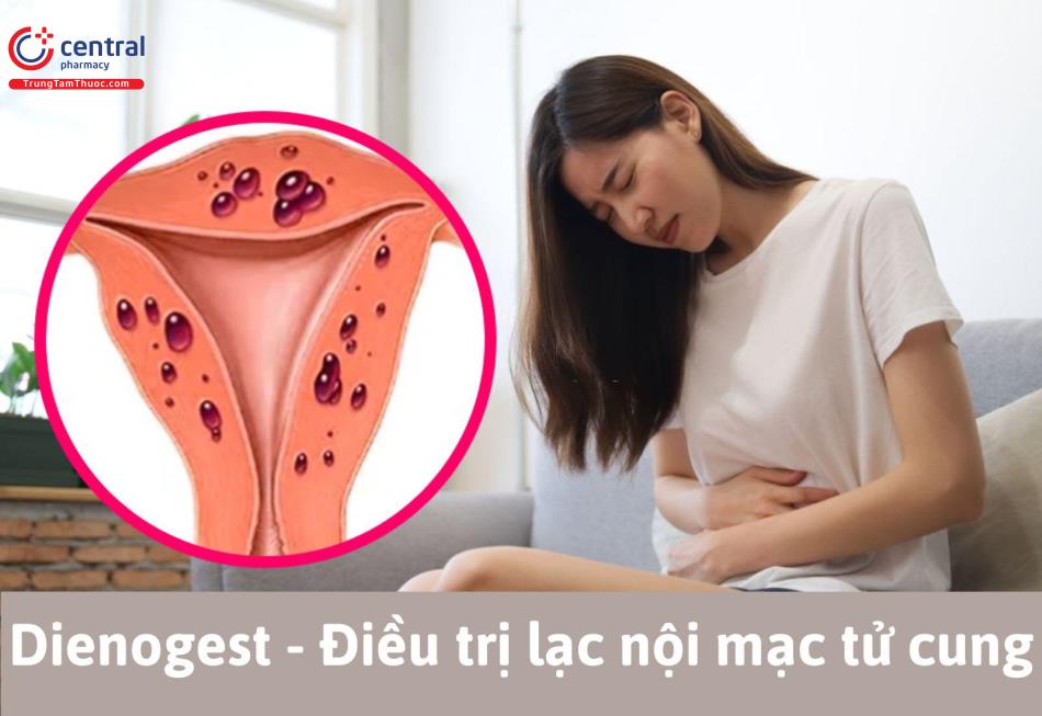 Dienogest điều trị lạc nội mạc tử cung