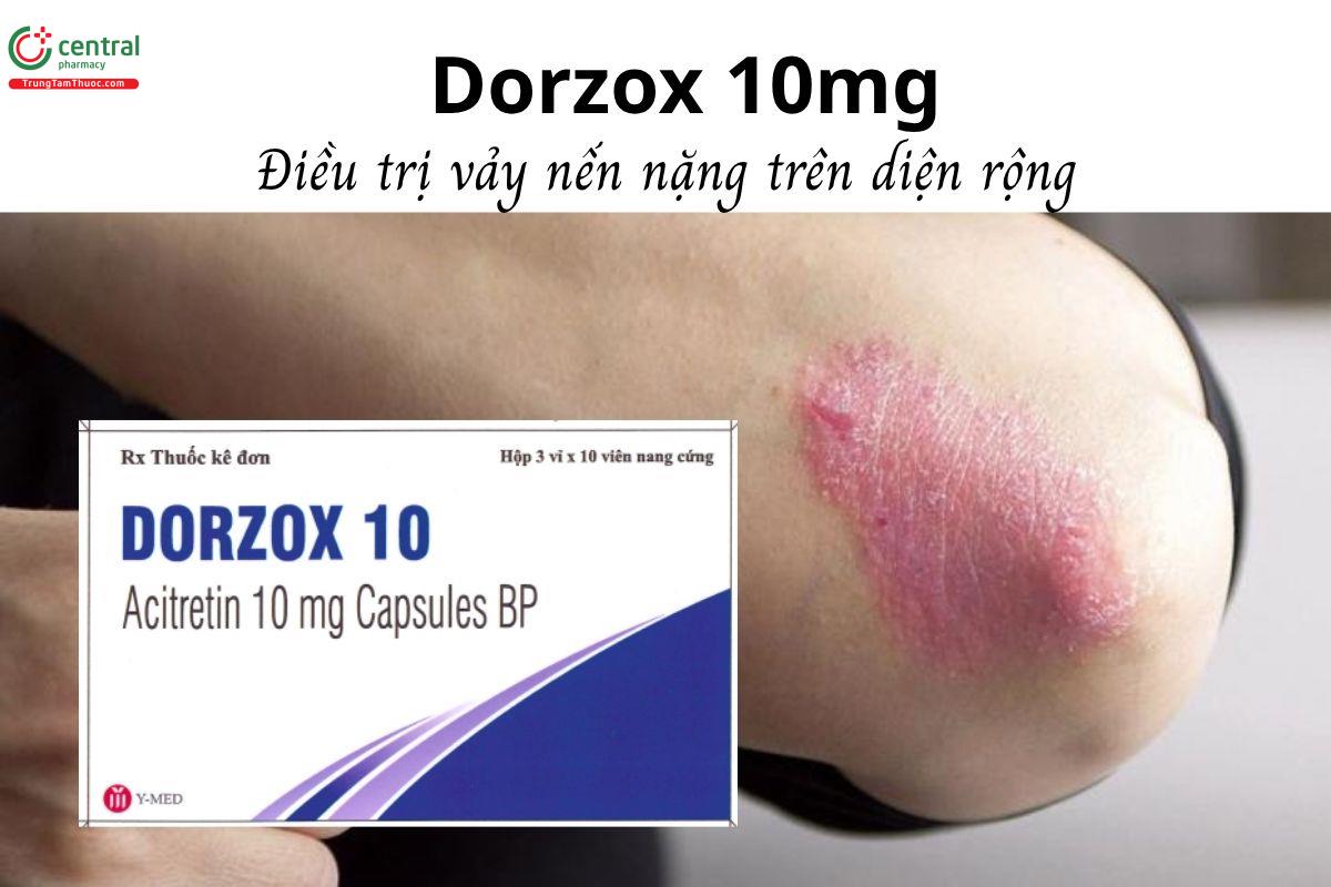Thuốc Dorzox 10mg - Điều trị vảy nến nặng trên diện rộng 