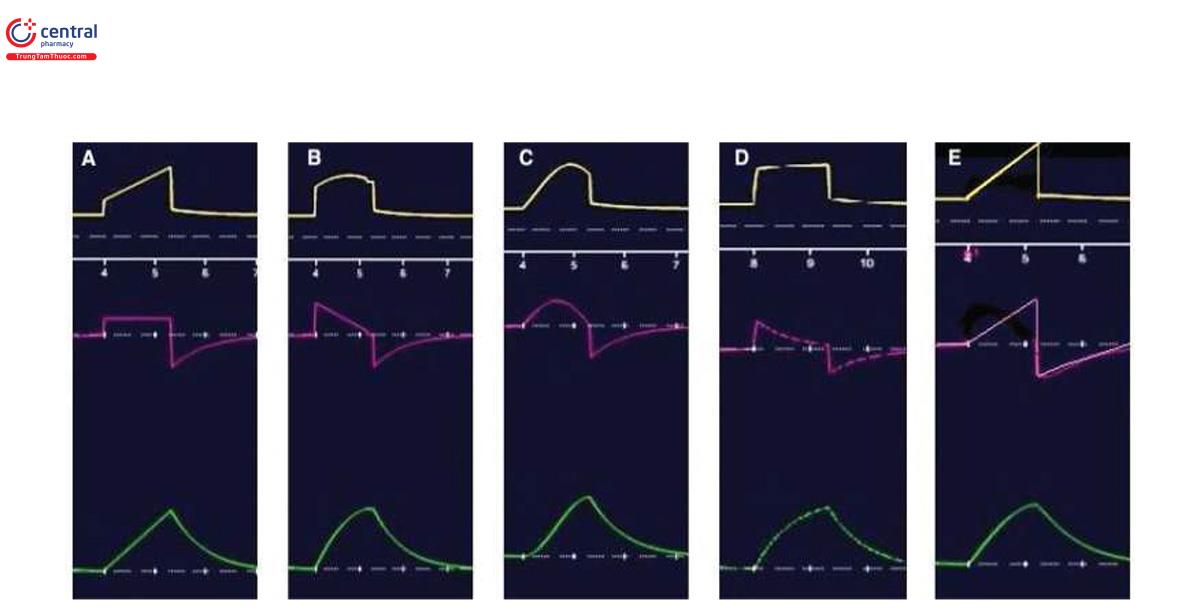 Hình 3 Dạng sóng lưu lượng điển hình được sử dụng bởi các chế độ máy thở khác nhau. Đường cong màu vàng phía trên là áp lực đường thở tính bằng cmH2O, đường cong màu hồng ở giữa là lưu lượng tính bằng L/phút và đường cong màu xanh lá cây phía dưới là thể tích khí lưu thông tính bằng mL. (A) Dạng sóng lưu lượng không đổi hoặc vuông, (B) giảm dần, (C) hình sin, (D) giảm tốc và (E) tăng dần.