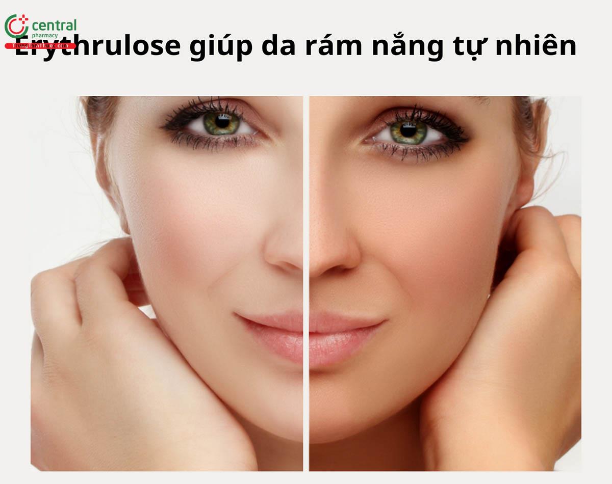 Nhuộm da bằng Erythrulose