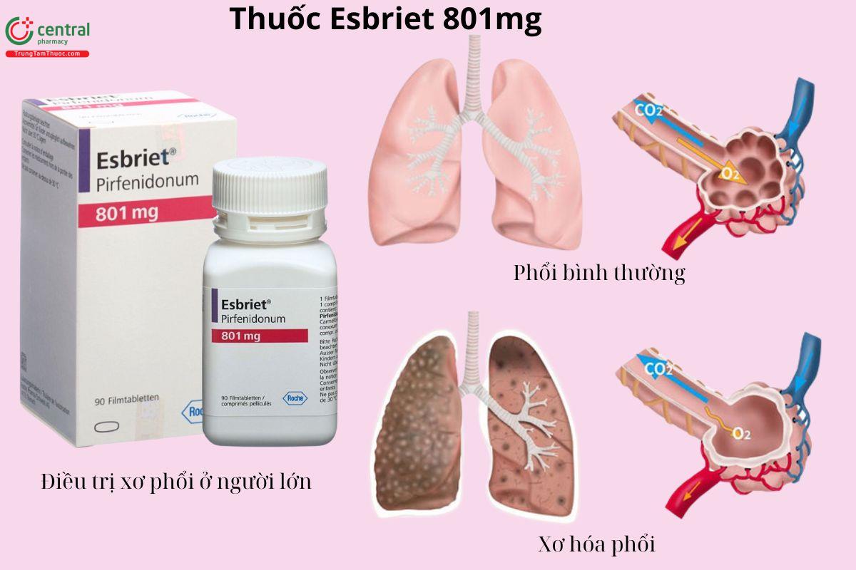 Chỉ định của thuốc Esbriet 801mg