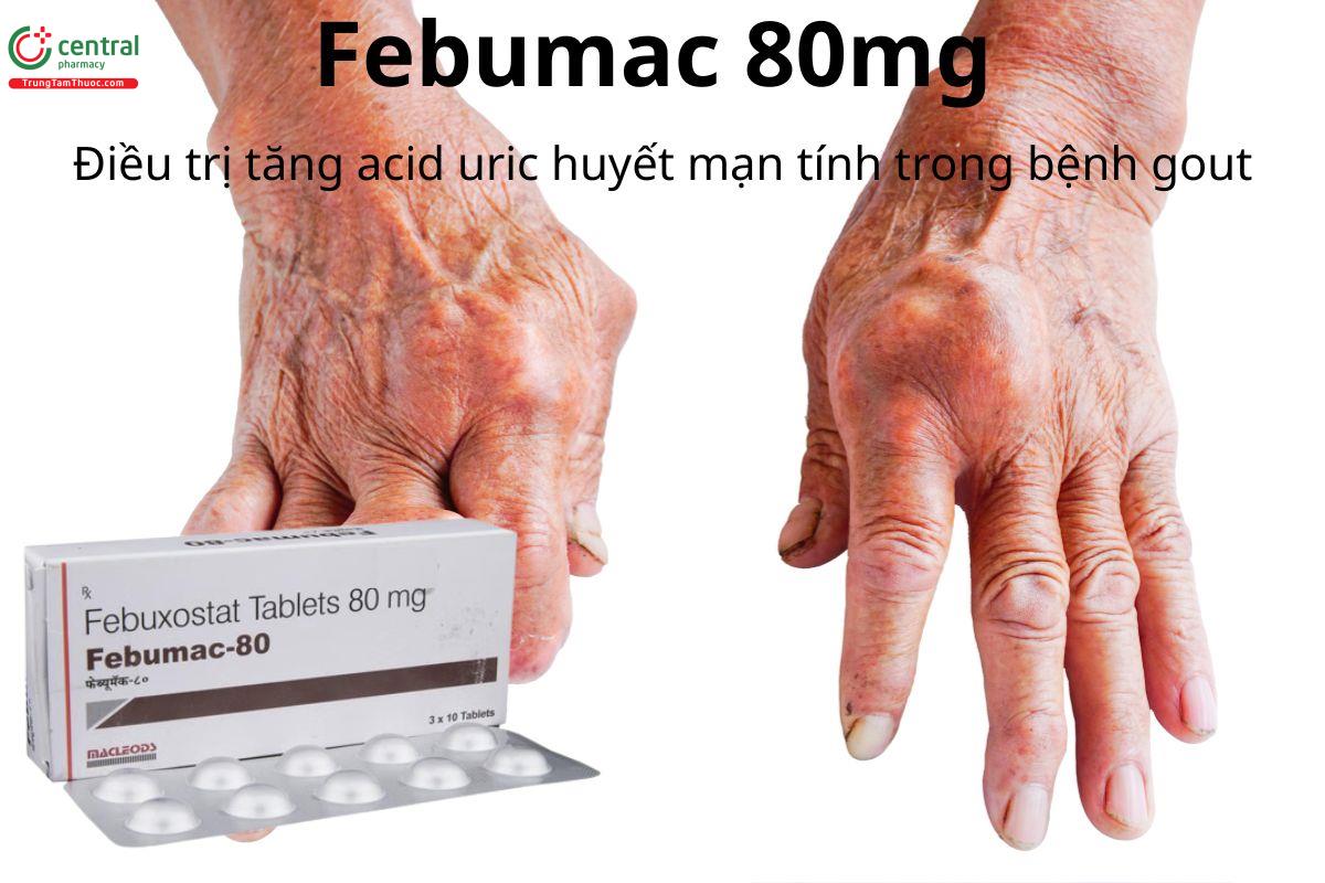 Thuốc Febumac 80mg điều trị tăng acid uric huyết trong bệnh gout