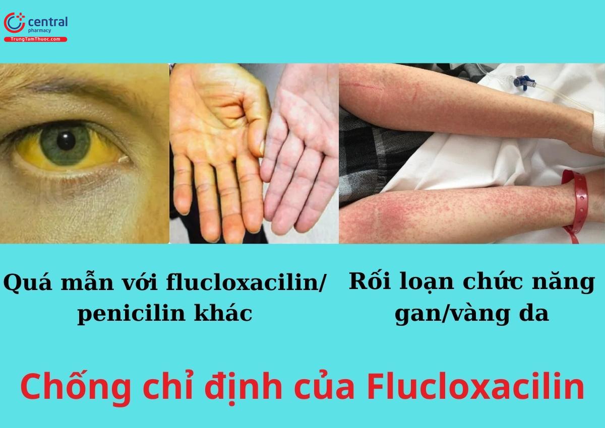 Chống chỉ định của Flucloxacilin