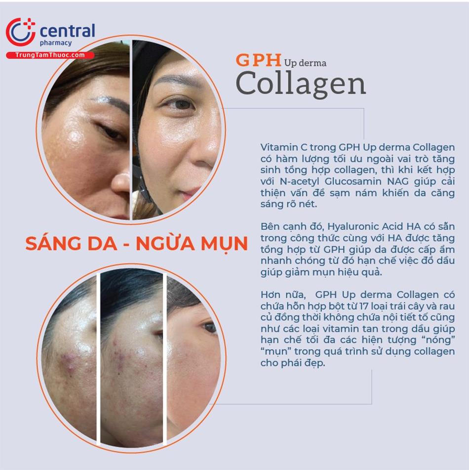 Tác dụng vượt trội của GPH Up derma Collagen