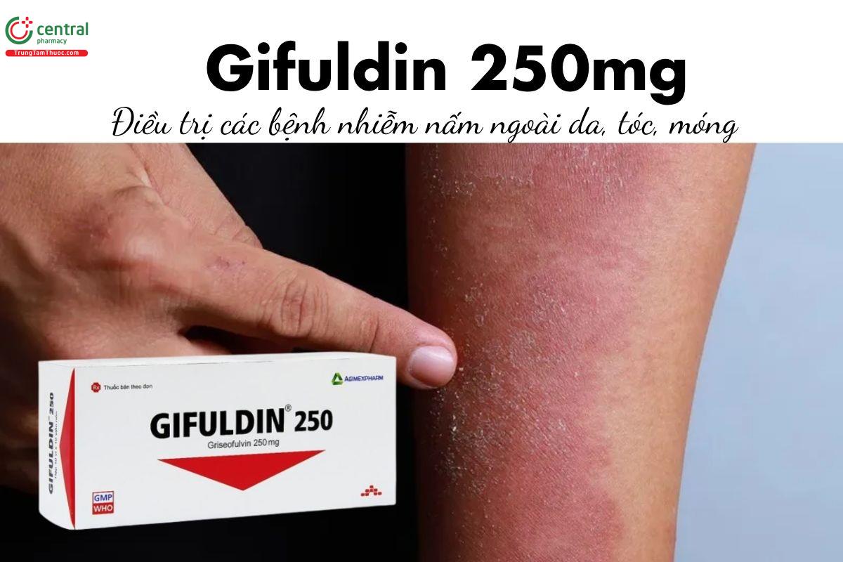 Thuốc Gifuldin 250mg - Điều trị các bệnh nhiễm nấm ngoài da, tóc, móng