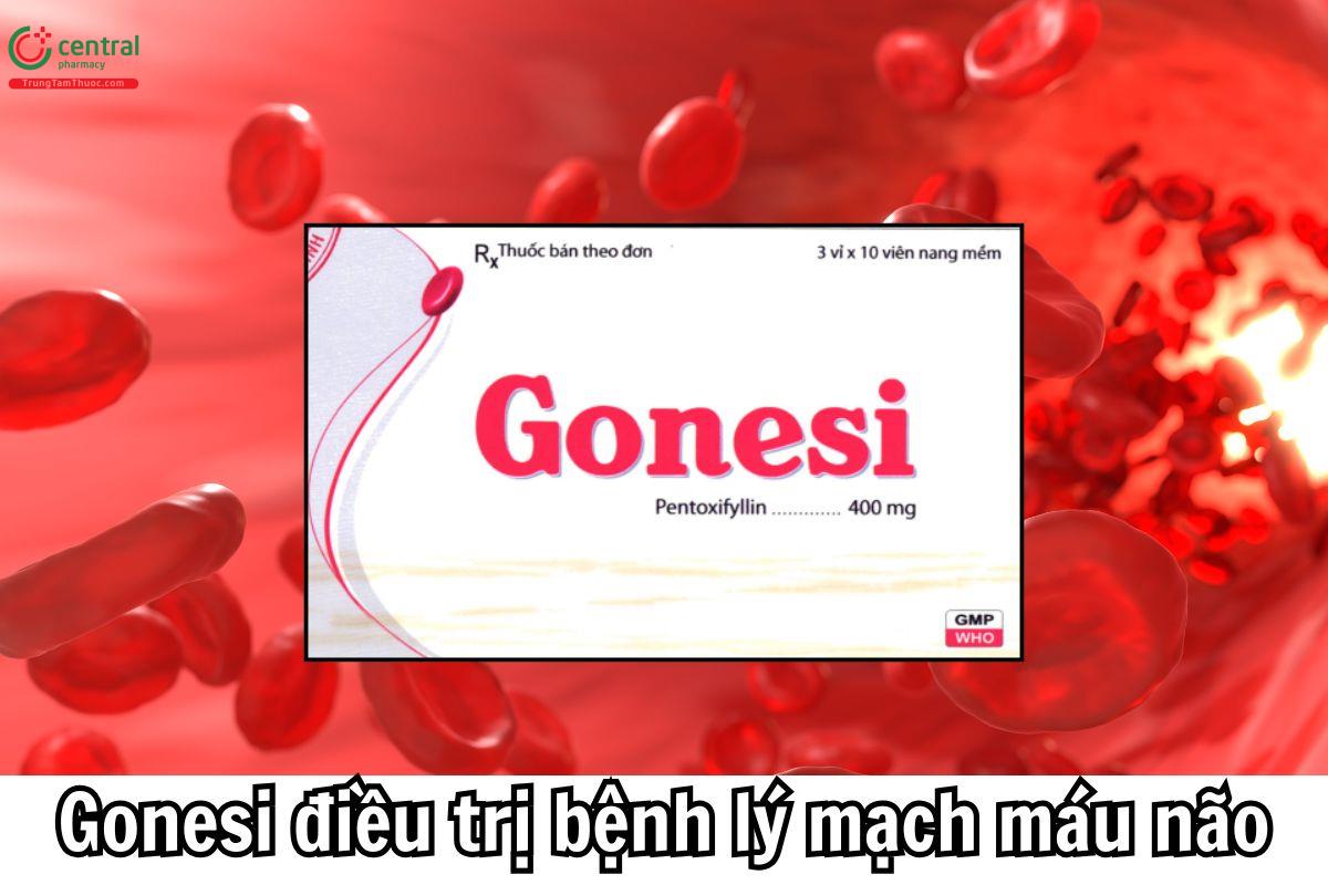 Gonesi