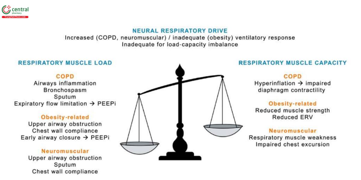 Hình 1. Suy hô hấp tăng CO2 có thể phát sinh do bơm hô hấp quá tải với công suất bơm giảm, có thể xảy ra ở bệnh nhân ổn định và phức tạp hơn trong thời gian mắc bệnh tái phát, hoặc có thể xảy ra cấp tỉnh mới. Trung khu điều hòa hô hấp thần kinh tăng lên để duy trì cân bằng nội môi thông khí, như trong bệnh phổi tắc nghẽn mạn tính (COPD) và bệnh thần kinh cơ, hoặc có thể bị giảm đi một cách không thích hợp, như trong suy hô hấp liên quan đến béo phì. ERV = thể tích dự trữ thở ra; PEEPi = áp lực dương cuối thì thở ra nội sinh.