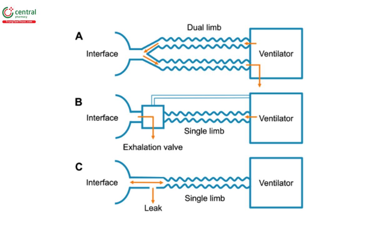Hình 7. Minh họa các loại bộ dây được sử dụng trong quá trình thở máy. (A) Mạch hai nhánh với các nhánh thở vào và thở ra, (B) mạch một nhánh với van thở ra chủ động và giao diện không thông hơi, và (C) mạch một nhánh với giao diện thông hơi.