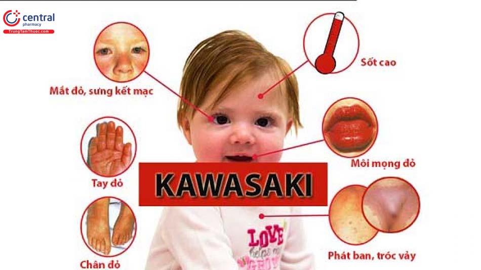Bênh Kawasaki có nhiều triệu chứng trên da