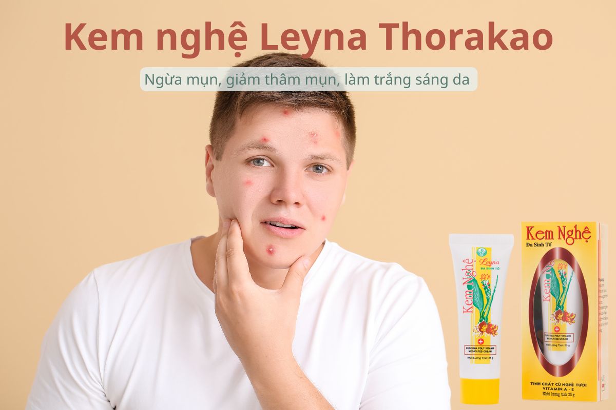 Kem nghệ Leyna Thorakao ngăn ngừ mụn, giảm thâm mụn, làm sáng da
