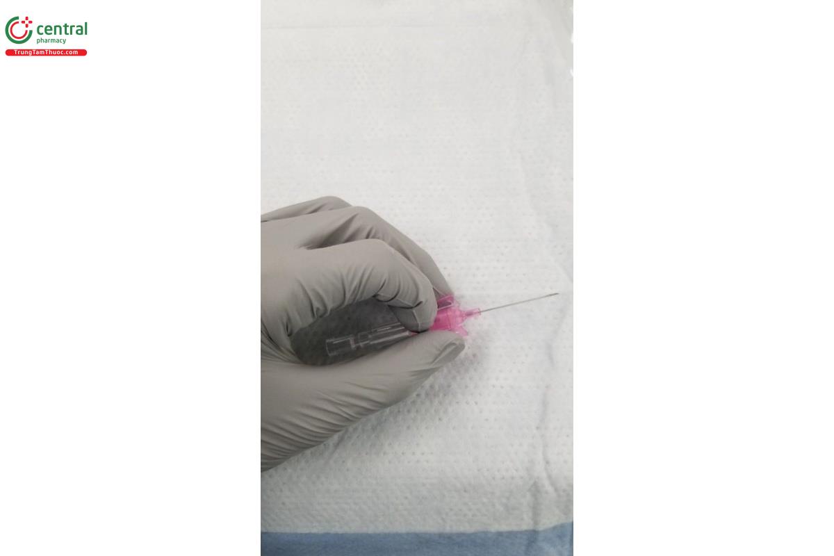 Hình ảnh thể hiện vị trí ngón trỏ trên catheter