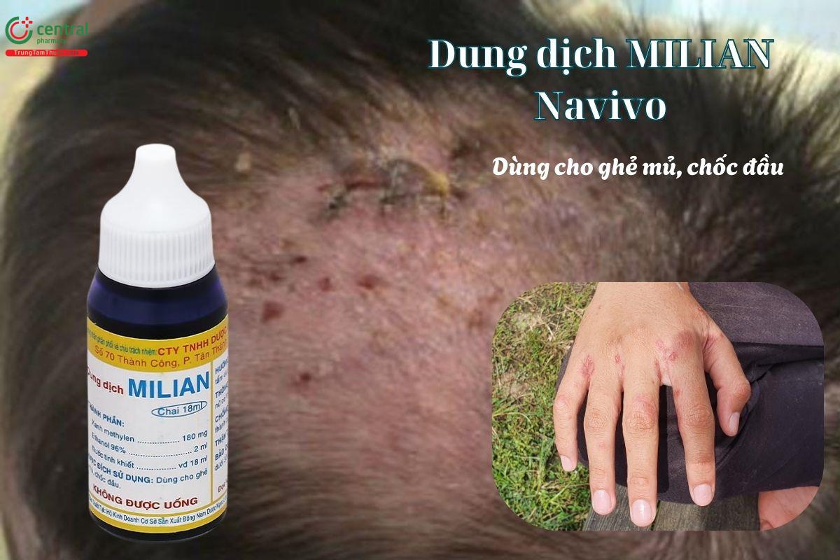 Dung dịch Milian Navico dùng cải thiện ghẻ mủ, chốc đầu