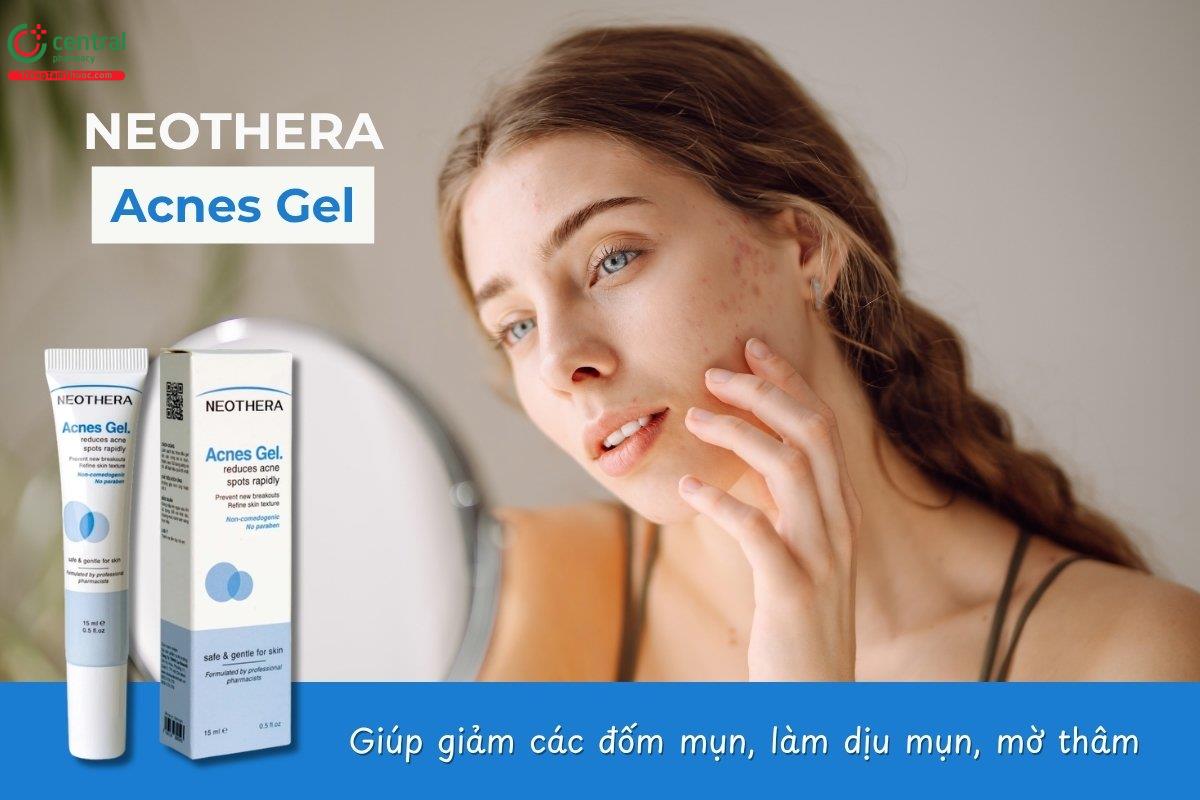 Gel trị mụn Neothera Acnes Gel giảm mụn hiệu quả và cải thiện thâm sẹo