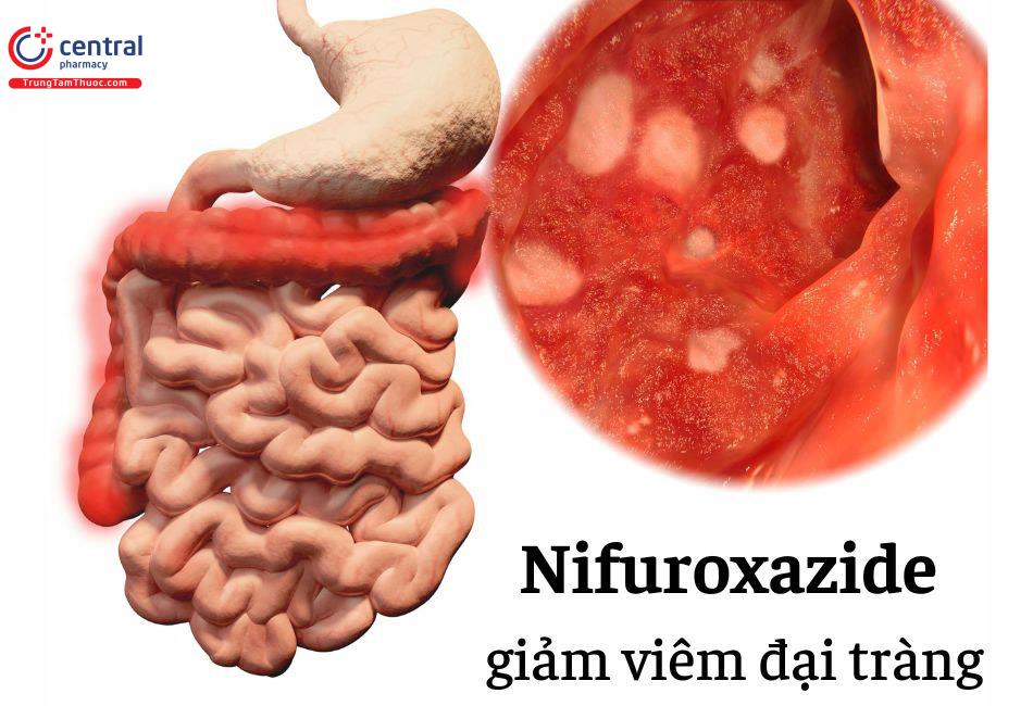 Nifuroxazide giảm nhanh viêm đại tràng