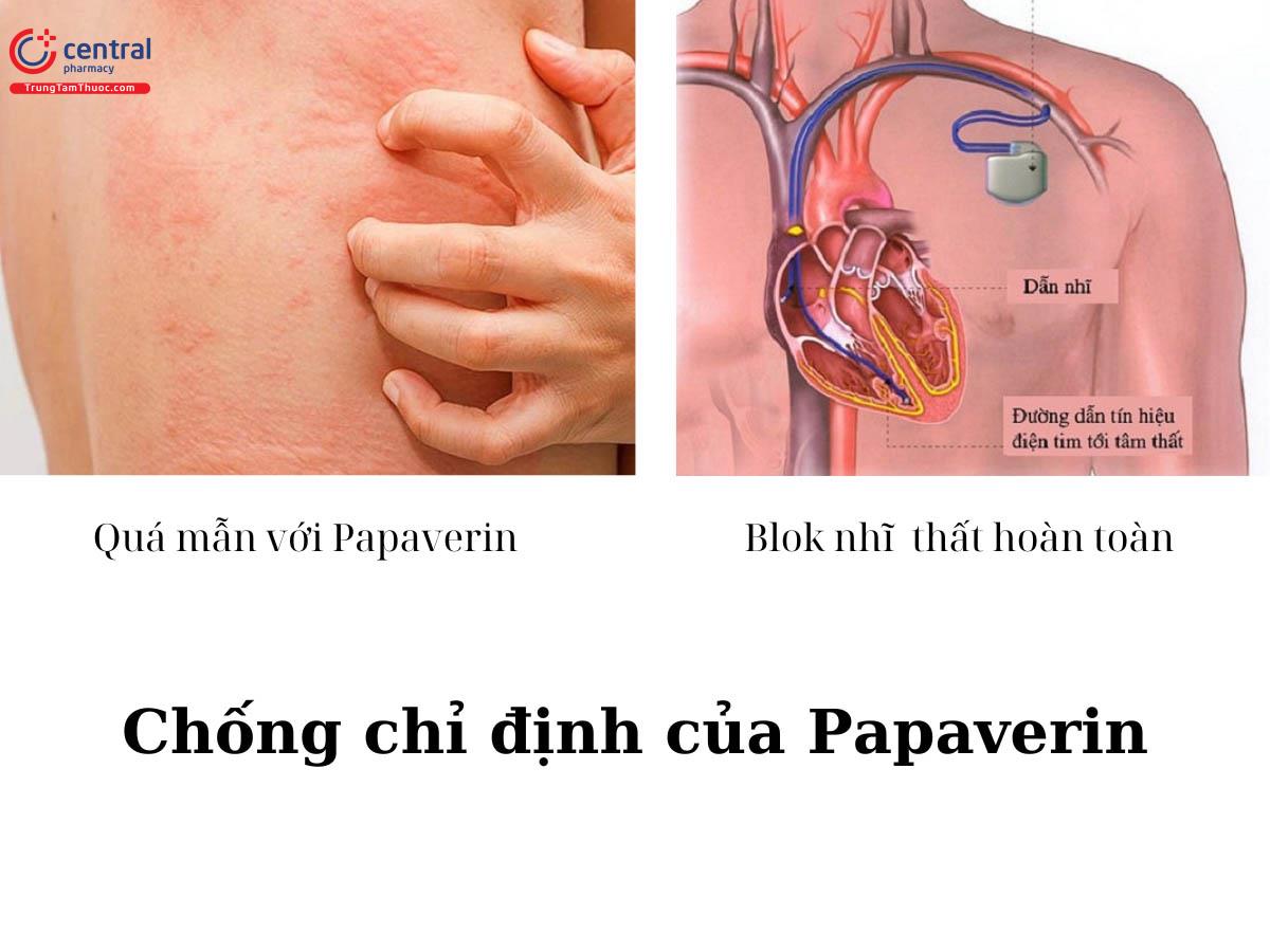 Chống chỉ định của Papaverin