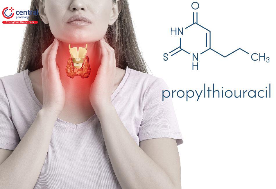 Propylthiouracil điều trị cường giáp