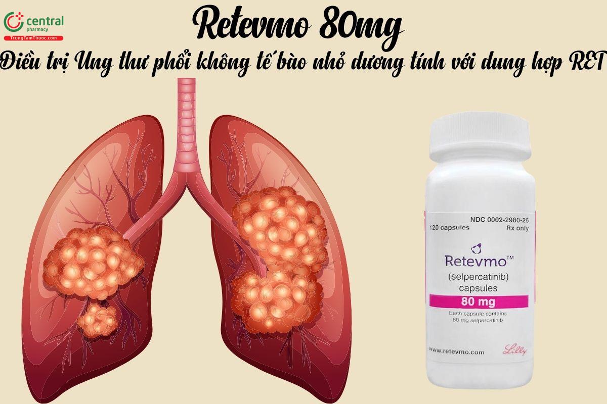 Retevmo 80mg chỉ định