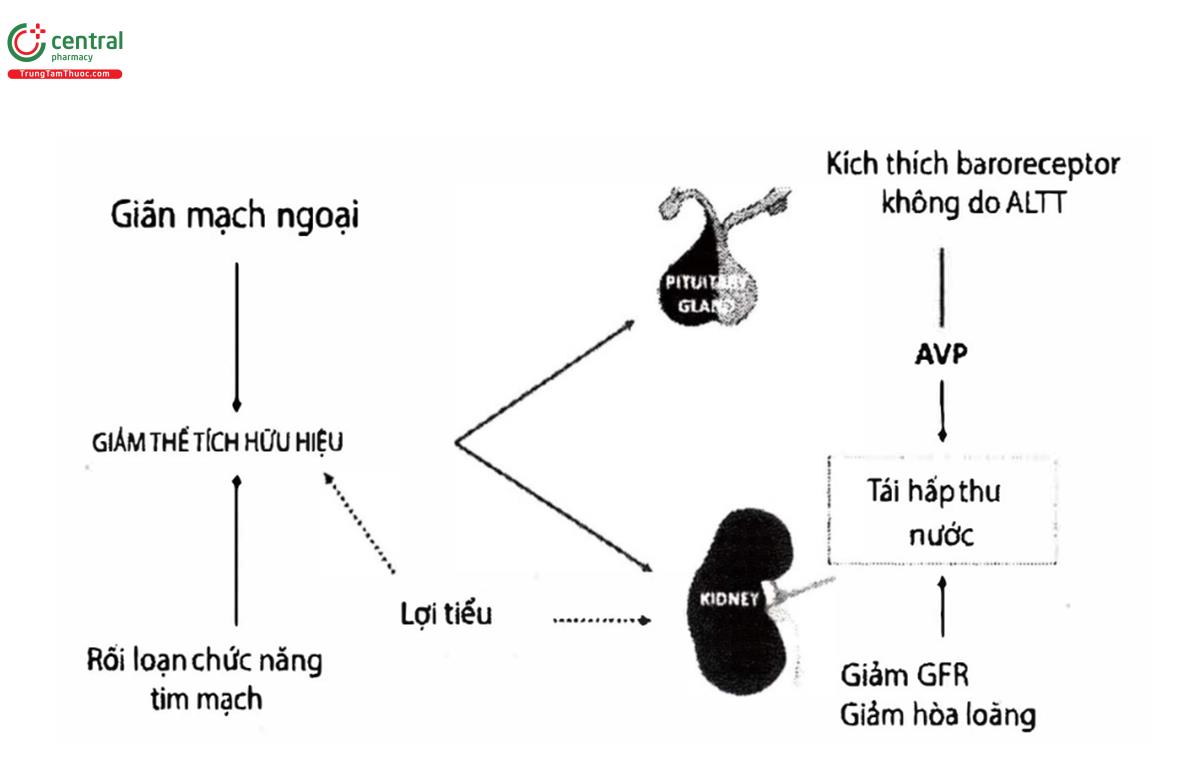 Hình 2: Cơ chế bệnh sinh của hạ Natri máu ở bệnh nhân xơ gan