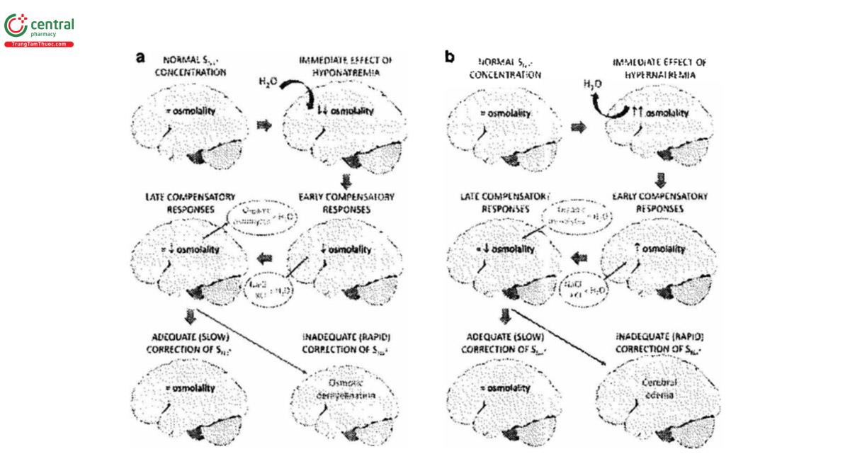 Hình 4: Quá trình hệ thần kinh trung ương tự điều chỉnh khi có rối loạn Natri máu