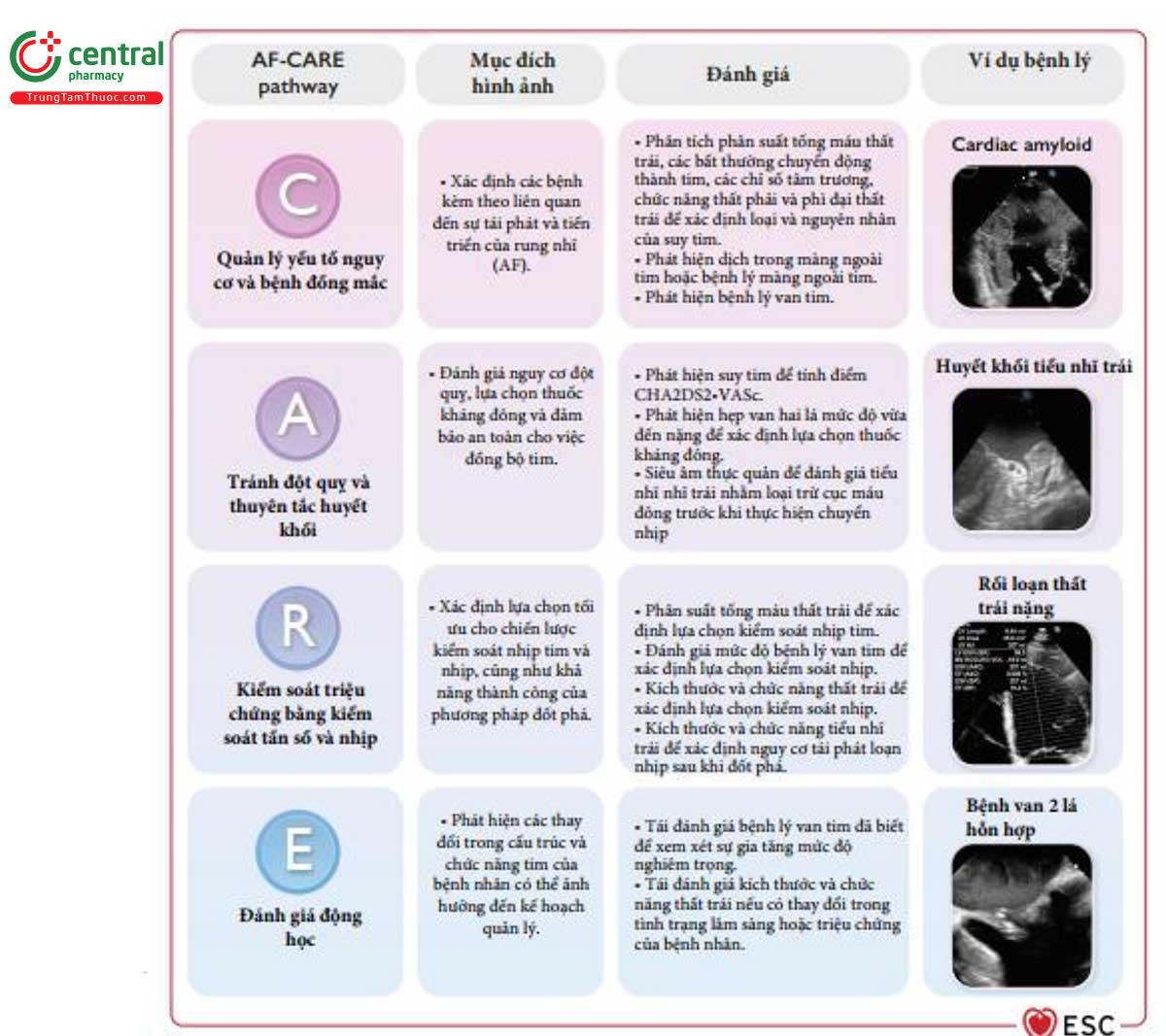 Figure 13 Tầm quan trọng của siêu âm tim trong lộ trình chăm sóc rung nhĩ (AF-CARE)