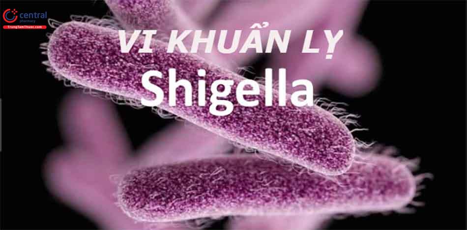 Nhiễm trùng lỵ trực khuẩn là do nhiễm Shigellae.