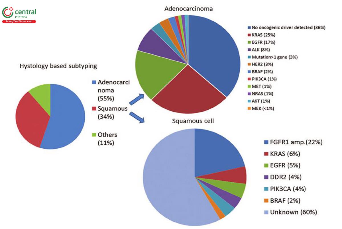 Hình 6. Tỷ lệ mô học ung thư phổi và đột biến gen xảy ra ở ung thư biểu mô tuyến và ung thư biểu mô vảy (25)