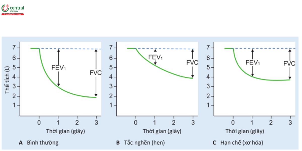 HÌNH 4.2 Dung tích sống gắng sức (FVC) và FEV1 ở người bình thường và ở bệnh nhân mắc bệnh phổi. FEV1 = thế tích thở ra trong giây đầu tiên thở ra tối đa gắng sức.